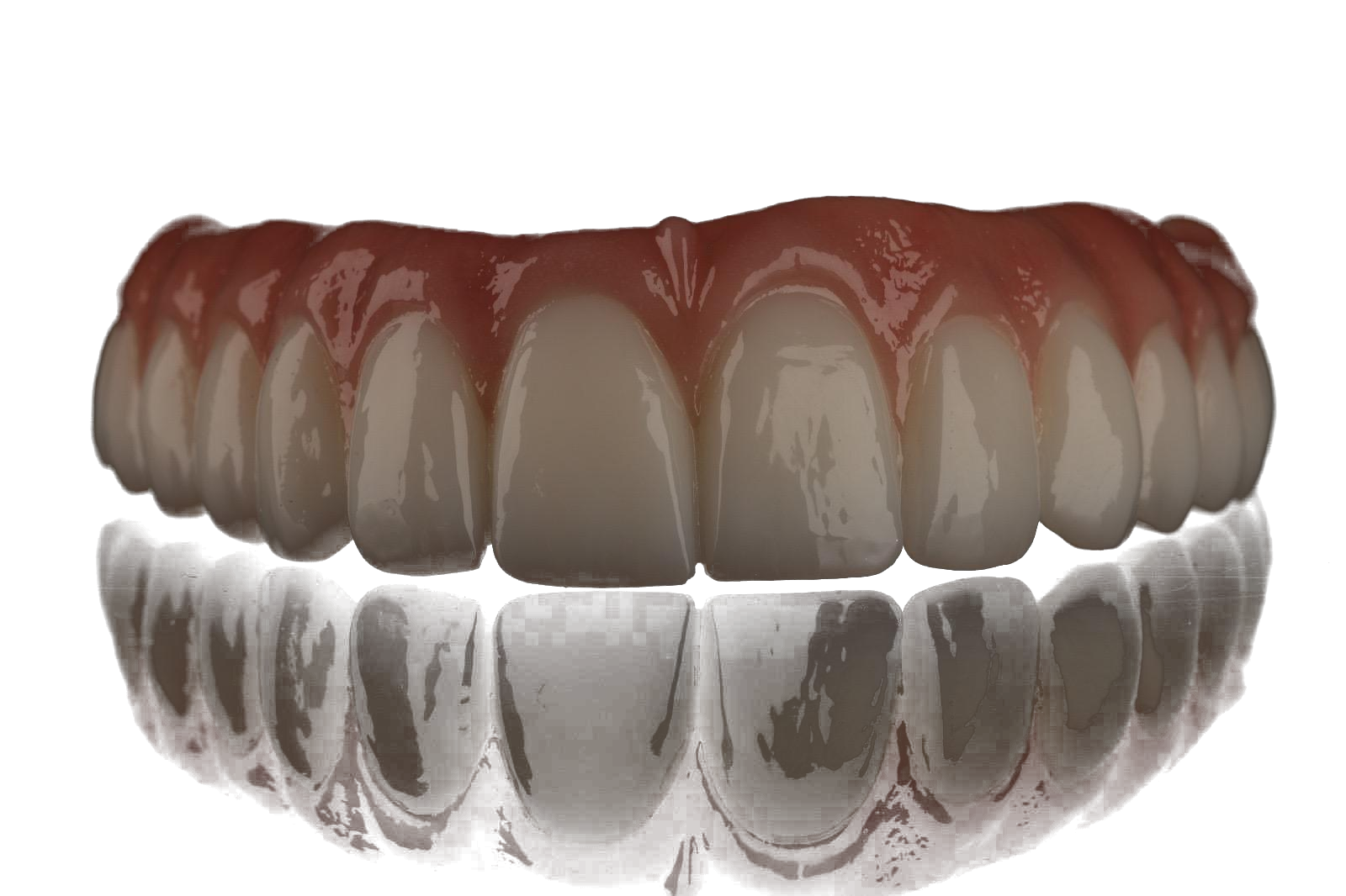Full-arch zirconia prosthesis