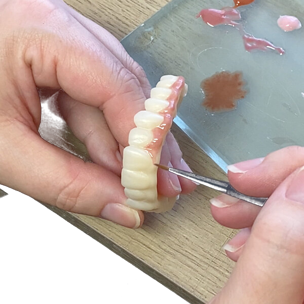 PMMA temporary