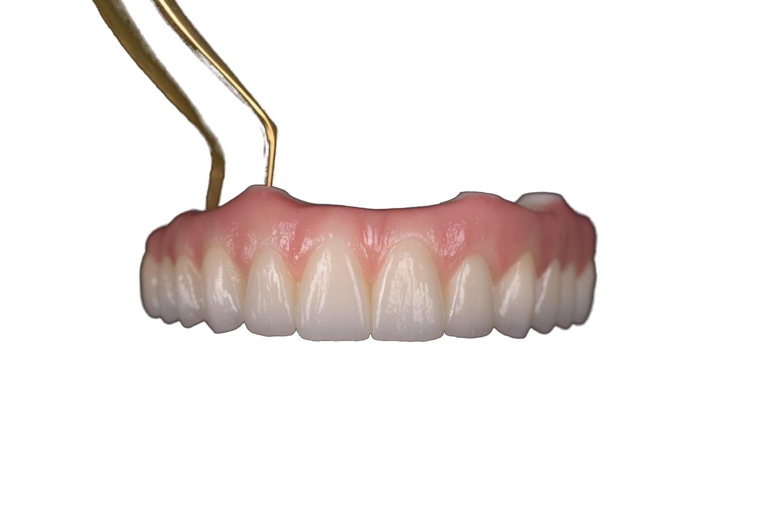 Milled prosthesis with implant framework